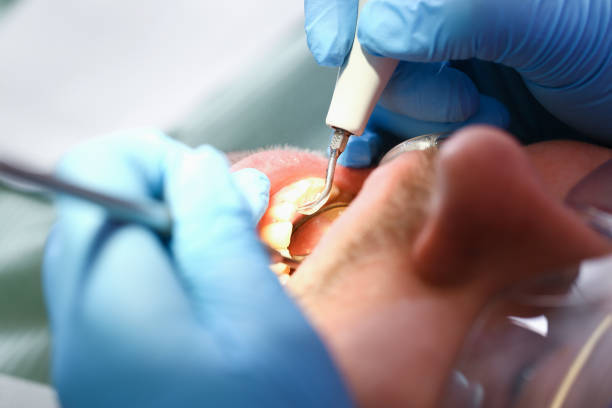 Best Emergency Dental Care for Sports Injuries in Esko, MN